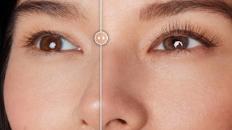 Results of RevitaLash Advanced Pro
