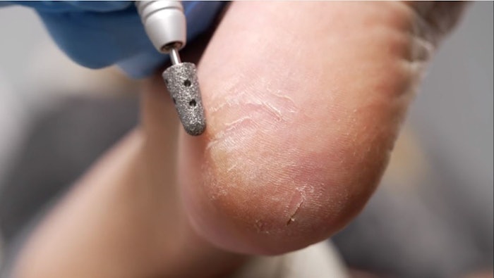 How To Dry Pedicure - Erica's ATA (Step 6, reduce callus)