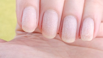 Learn what causes nail damage and what steps you can take to help your clients care for their nails.