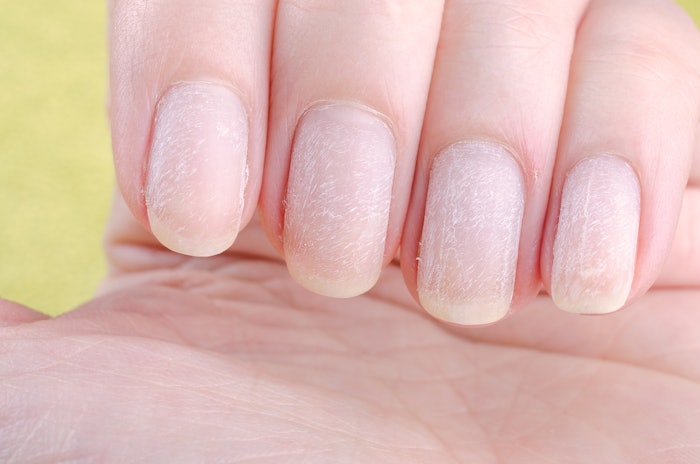 Learn what causes nail damage and what steps you can take to help your clients care for their nails.