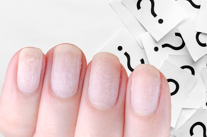 After reading Nailpro's nail clinic column on repairing nails, see what you learned with this quiz.