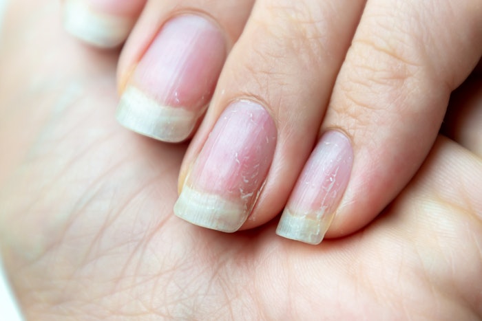 Here are some techniques various nail technicians have recommended for banishing the dreaded yellow.