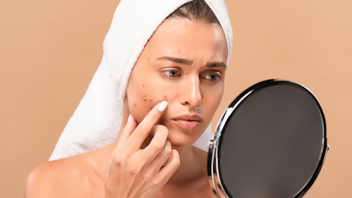 Woman checking her acne in mirror