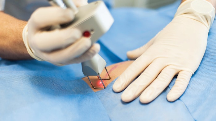 The doctor makes a laser correction of the scar on the skin