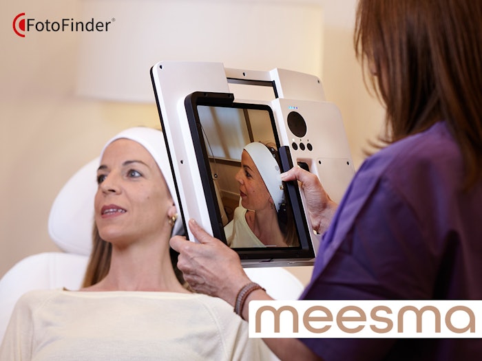 Foto Finder Meesma (2)