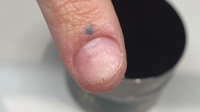 This is after prepping the nail.