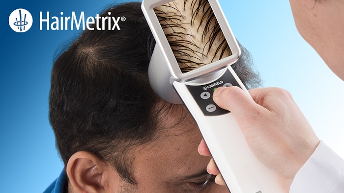 Hair Metrix Lead Image 800x450