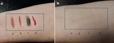 Ct2407 08 Lad Figure 5