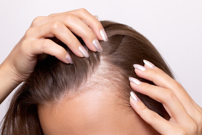 Elevai Labs Inc. launches S-Series Root Renewal System combining exosome and mitochondrial technology to target scalp and hair health at the cellular level.