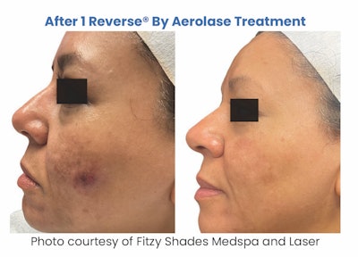 Screenshot 2024 11 19 At 6 32 15γç»am