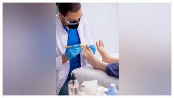 Mia Barnes dives into an emerging technology designed for nail professionals to help them safely treat clients with nail fungus.