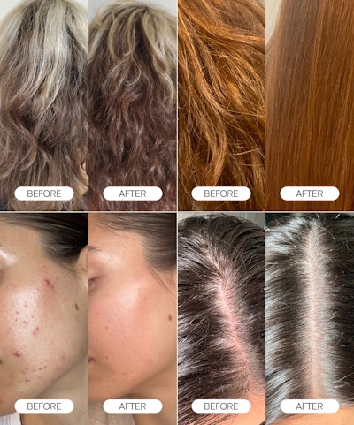 Four client before & afters using a Canopy Showerhead.