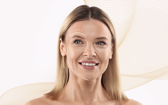 Silab Liftilience (3)