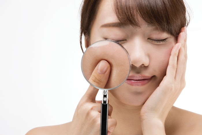 Treatments like dermabrasion and IPL may increase TEWL because they remove the stratum corneum.