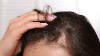 Hair loss is a common condition in men, but that doesn't mean women aren't affected either. BON CHARGE seeks to leverage the latest in red light technology and scalp health to help mitigate the issue.