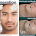 Lira Clinical has been long respected for its use of advanced technology and ingredients.