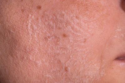 Growing consumer awareness means that skin is no longer a one-size-fits-all; now they're looking into their specific skin needs.