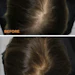 Before and after scalp comparison showing hair density improvement from hair treatment